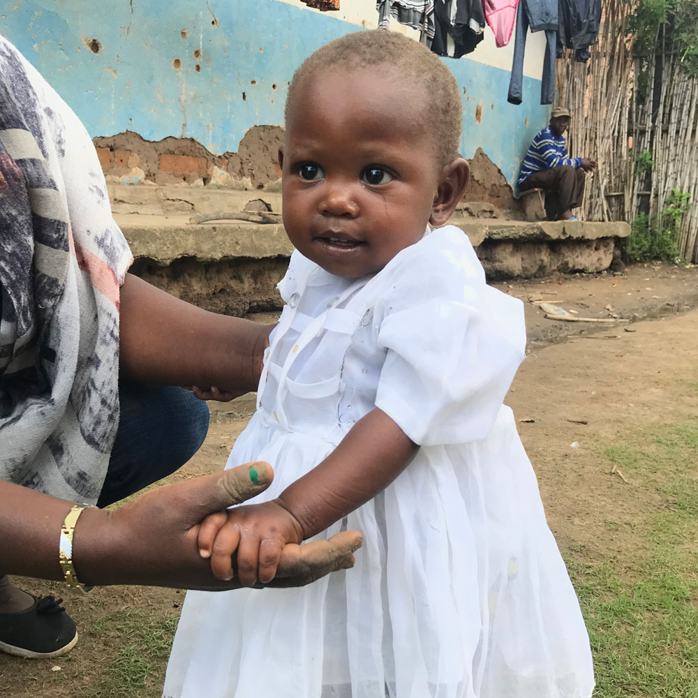 Eighteen month old Diela in a white dress standing, now in recovery and growing strong.