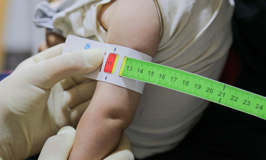 The mid-upper arm circumference (MUAC) tape for malnutrition testing.