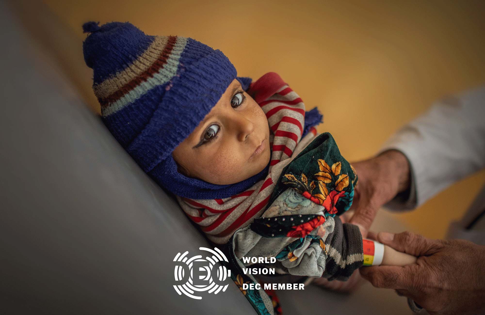 A baby is screened for malnutrition at a health clinic in Afghanistan
